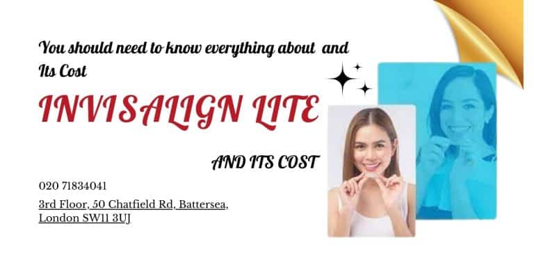 Invisalign Lite and Its Cost