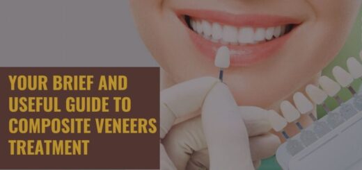 Your brief and useful guide to composite veneers treatment